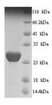 SLC26A5 Protein - (Tris-Glycine gel) Discontinuous SDS-PAGE (reduced) with 5% enrichment gel and 15% separation gel.