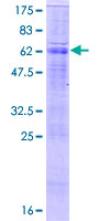SLC26A5 Protein - 12.5% SDS-PAGE of human SLC26A5 stained with Coomassie Blue