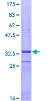 SLC26A6 / PAT1 Protein - 12.5% SDS-PAGE Stained with Coomassie Blue.