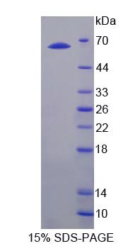 SLC26A8 / TAT1 Protein - Recombinant  Testis Anion Transporter 1 By SDS-PAGE