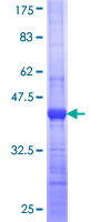 SLC26A9 Protein - 12.5% SDS-PAGE Stained with Coomassie Blue.