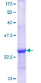 SLC27A1 / FATP Protein - 12.5% SDS-PAGE Stained with Coomassie Blue.