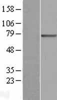 SLC27A3 Protein - Western validation with an anti-DDK antibody * L: Control HEK293 lysate R: Over-expression lysate