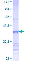 SLC27A3 Protein - 12.5% SDS-PAGE Stained with Coomassie Blue.