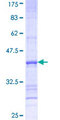 SLC27A3 Protein - 12.5% SDS-PAGE Stained with Coomassie Blue.