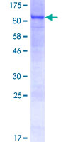 SLC27A5 / BACS Protein - 12.5% SDS-PAGE of human SLC27A5 stained with Coomassie Blue