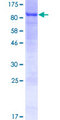 SLC27A5 / BACS Protein - 12.5% SDS-PAGE of human SLC27A5 stained with Coomassie Blue