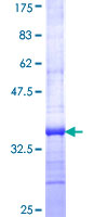 SLC27A5 / BACS Protein - 12.5% SDS-PAGE Stained with Coomassie Blue.