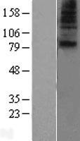 SLC28A1 Protein - Western validation with an anti-DDK antibody * L: Control HEK293 lysate R: Over-expression lysate