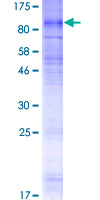 SLC28A2 Protein - 12.5% SDS-PAGE of human SLC28A2 stained with Coomassie Blue