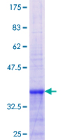 SLC28A2 Protein - 12.5% SDS-PAGE Stained with Coomassie Blue.