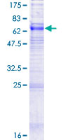 SLC29A1 / ENT1 Protein - 12.5% SDS-PAGE of human SLC29A1 stained with Coomassie Blue