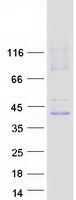 SLC29A1 / ENT1 Protein - Purified recombinant protein SLC29A1 was analyzed by SDS-PAGE gel and Coomassie Blue Staining