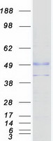 SLC29A2 / ENT2 Protein - Purified recombinant protein SLC29A2 was analyzed by SDS-PAGE gel and Coomassie Blue Staining