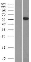 SLC29A4 Protein - Western validation with an anti-DDK antibody * L: Control HEK293 lysate R: Over-expression lysate