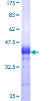 SLC29A4 Protein - 12.5% SDS-PAGE Stained with Coomassie Blue.