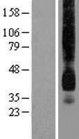SLC2A1 / GLUT-1 Protein - Western validation with an anti-DDK antibody * L: Control HEK293 lysate R: Over-expression lysate