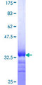 SLC2A10 / GLUT10 Protein - 12.5% SDS-PAGE Stained with Coomassie Blue.