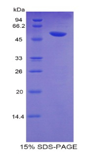 SLC2A14 Protein - Recombinant Glucose Transporter 14 By SDS-PAGE