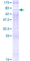 SLC2A2 / GLUT2 Protein - 12.5% SDS-PAGE of human SLC2A2 stained with Coomassie Blue