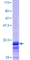 SLC2A2 / GLUT2 Protein - 12.5% SDS-PAGE Stained with Coomassie Blue.