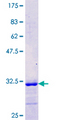 SLC2A3 / GLUT3 Protein - 12.5% SDS-PAGE Stained with Coomassie Blue.