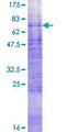 SLC2A4 / GLUT-4 Protein - 12.5% SDS-PAGE of human SLC2A4 stained with Coomassie Blue