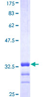 SLC2A4 / GLUT-4 Protein - 12.5% SDS-PAGE Stained with Coomassie Blue.