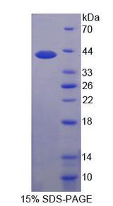 SLC2A4 / GLUT-4 Protein - Recombinant Glucose Transporter 4 (GLUT4) by SDS-PAGE