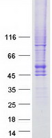 SLC2A4 / GLUT-4 Protein - Purified recombinant protein SLC2A4 was analyzed by SDS-PAGE gel and Coomassie Blue Staining