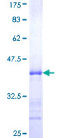 SLC2A4RG / GEF Protein - 12.5% SDS-PAGE Stained with Coomassie Blue.
