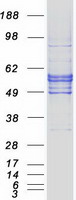 SLC2A5 / GLUT5 Protein - Purified recombinant protein SLC2A5 was analyzed by SDS-PAGE gel and Coomassie Blue Staining
