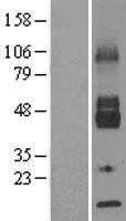 SLC2A6 / GLUT6 Protein - Western validation with an anti-DDK antibody * L: Control HEK293 lysate R: Over-expression lysate