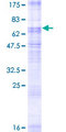 SLC2A8 / GLUT8 Protein - 12.5% SDS-PAGE of human SLC2A8 stained with Coomassie Blue