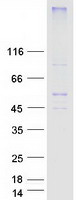SLC2A8 / GLUT8 Protein - Purified recombinant protein SLC2A8 was analyzed by SDS-PAGE gel and Coomassie Blue Staining