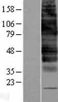 SLC2A9 / GLUT9 Protein - Western validation with an anti-DDK antibody * L: Control HEK293 lysate R: Over-expression lysate