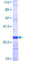 SLC2A9 / GLUT9 Protein - 12.5% SDS-PAGE Stained with Coomassie Blue.