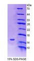 SLC30A3 / ZNT3 Protein - Recombinant  Solute Carrier Family 30, Member 3 By SDS-PAGE