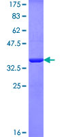 SLC30A4 Protein - 12.5% SDS-PAGE Stained with Coomassie Blue