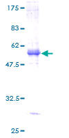 SLC30A6 Protein - 12.5% SDS-PAGE of human SLC30A6 stained with Coomassie Blue