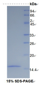 SLC30A8 / ZNT8 Protein - Recombinant Solute Carrier Family 30 Member 8 By SDS-PAGE