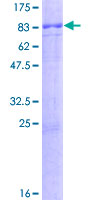 SLC30A9 / ZNT9 Protein - 12.5% SDS-PAGE of human SLC30A9 stained with Coomassie Blue