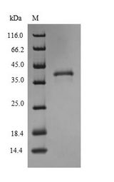 SLC31A1 / CTR1 Protein - (Tris-Glycine gel) Discontinuous SDS-PAGE (reduced) with 5% enrichment gel and 15% separation gel.