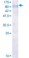 SLC33A1 Protein - 12.5% SDS-PAGE of human SLC33A1 stained with Coomassie Blue