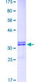 SLC33A1 Protein - 12.5% SDS-PAGE Stained with Coomassie Blue.