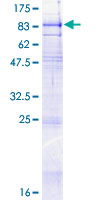 SLC34A1 / NPT2 Protein - 12.5% SDS-PAGE of human SLC34A1 stained with Coomassie Blue