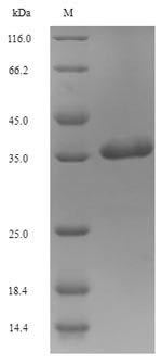 SLC34A2 / NaPi-2b Protein - (Tris-Glycine gel) Discontinuous SDS-PAGE (reduced) with 5% enrichment gel and 15% separation gel.