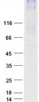 SLC34A2 / NaPi-2b Protein - Purified recombinant protein SLC34A2 was analyzed by SDS-PAGE gel and Coomassie Blue Staining