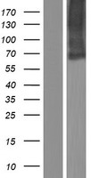 SLC34A3 / NaPi-2c Protein - Western validation with an anti-DDK antibody * L: Control HEK293 lysate R: Over-expression lysate