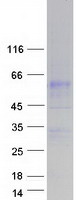SLC34A3 / NaPi-2c Protein - Purified recombinant protein SLC34A3 was analyzed by SDS-PAGE gel and Coomassie Blue Staining
